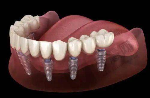 马方医生做完手术的感觉