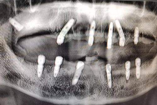 马方医生真实评价
