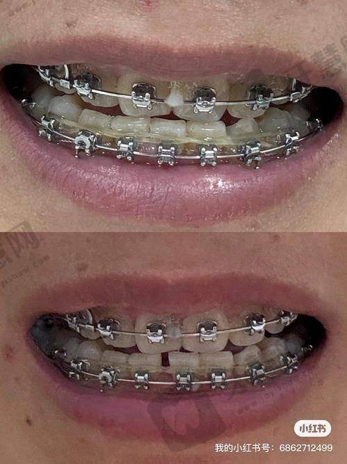 徐秋霞医生手术费用