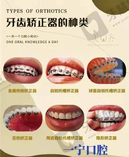 张余新医生做完手术的感受:修复过程可接受