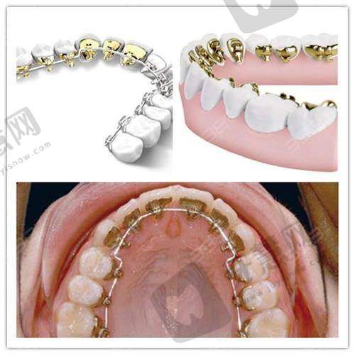 张余新医生怎么挂号预约:多种方式可选