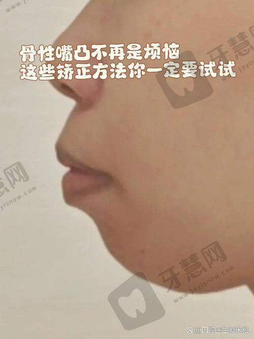 张余新医生真实评价:口碑出色值得推荐