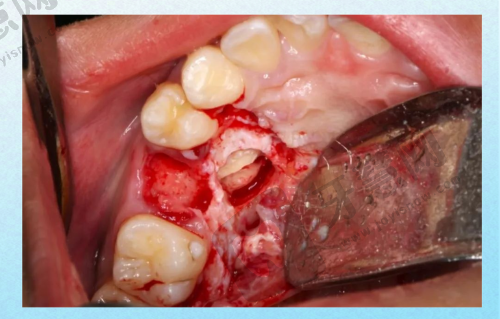 长沙市做乳牙拔除哪家好?排名前十口腔医院名单公布,专业儿童牙科拔乳牙200元起