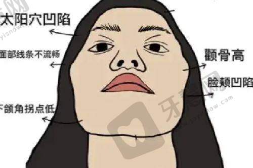 昆明艺星整形医院价格表含艺星吸脂丰胸隆鼻费用明细之隆鼻价格详情