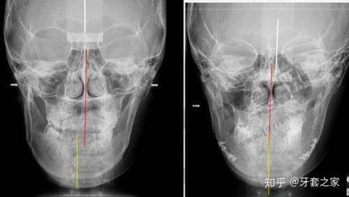 昆明艺星整形医院价格表：吸脂9880元起、丰胸19800元起，医生技术靠谱