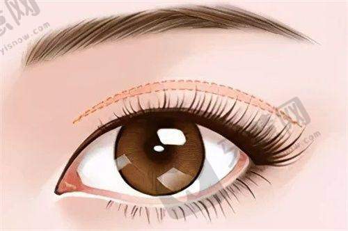 佳木斯韩艺来医疗美容医院医生水平如何