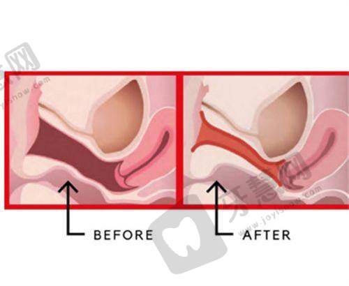 昆明艺星整形医院价格表含艺星吸脂丰胸隆鼻费用明细之顾客好评