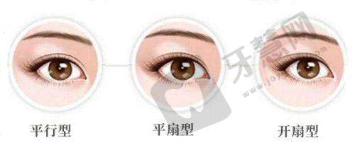 上海隆胸价格及坐诊时间公开详情