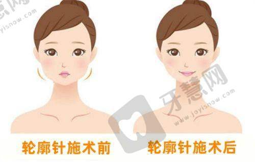 昆明娇点整形靠谱吗