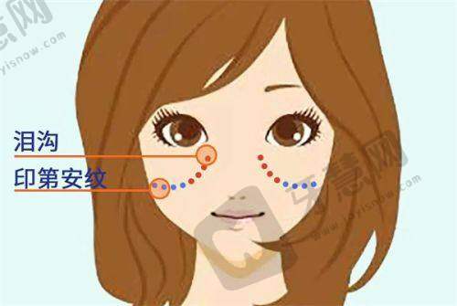 北京加减美穆宝安拉皮手术安心性有保护吗