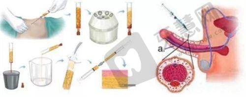 昆明丽都仁爱整形医院靠谱吗