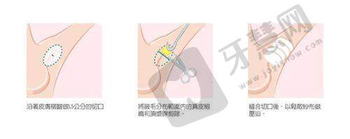 黑龙江艺星医疗美容医院医生名气大吗
