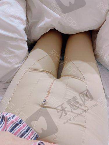 艺星自体脂肪移植隆胸:徐淑卿亲诊|成活率高|2025成效稳费用不贵!