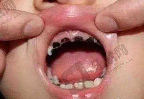 四、广州暨南雅皓口腔医院的患者评价