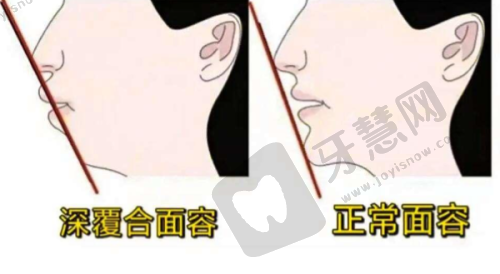 七、南宁岭南口腔——老牌牙科的种植优势