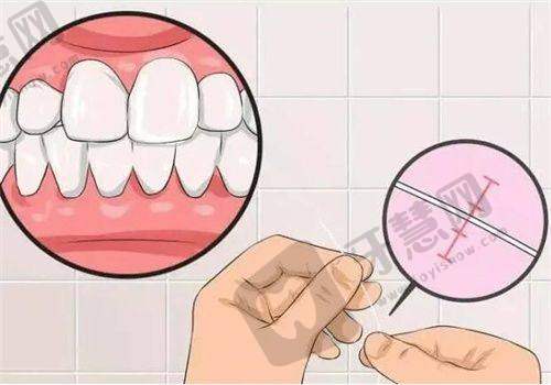 二、广州暨南雅皓口腔医院2025全新收费揭秘