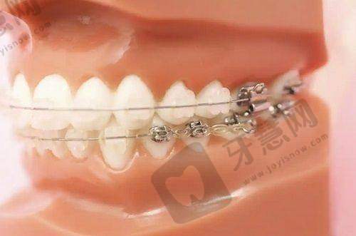 成都英博口腔医院种植牙怎么样？种牙技术硬核，价格亲民口碑佳案例多