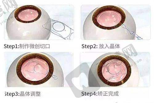 2025北京同仁医院眼科医生排名榜医生——排名大揭晓