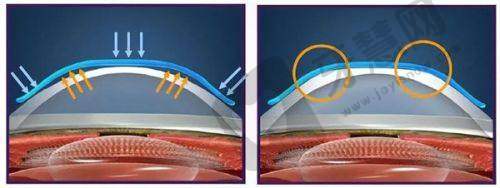 北京眼科王乐今简介：全国排名前三，擅长斜视与后巩膜加固术，北京熙仁易挂号