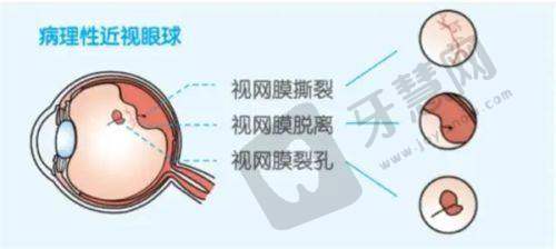 普瑞眼科私立医院与公办医院相比如何